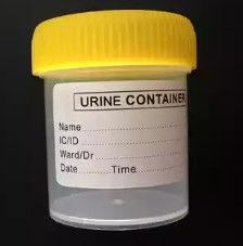 OEM medico su ordinazione della muffa del collettore dell'urina dello stampaggio ad iniezione ug/di cad